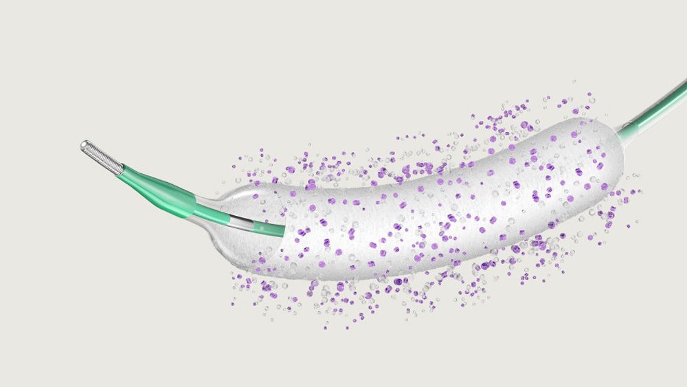 SeQuent® SCB – Sirolimus coated balloon