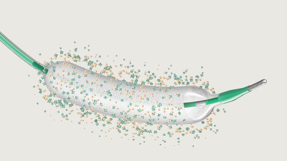 Paclitaxel coated balloon SeQuent® Please NEO