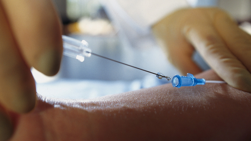 Hands of a medical worker insert a needle in the vascular accesss port