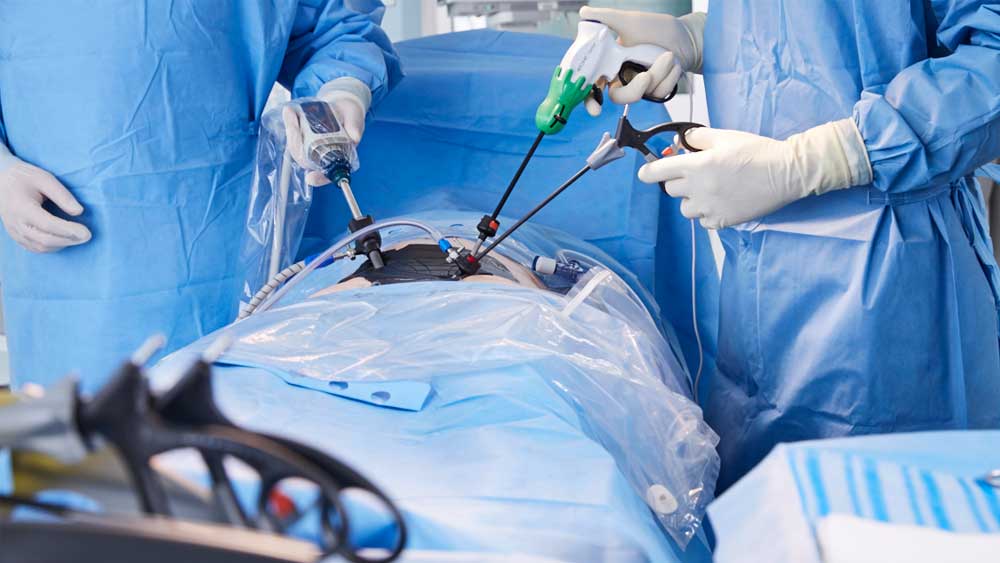 A detail of a minimally invasive surgery situation with AESCULAP Caiman