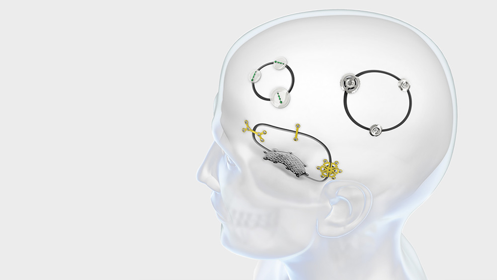 A transparent image of a human head, showing internal structures