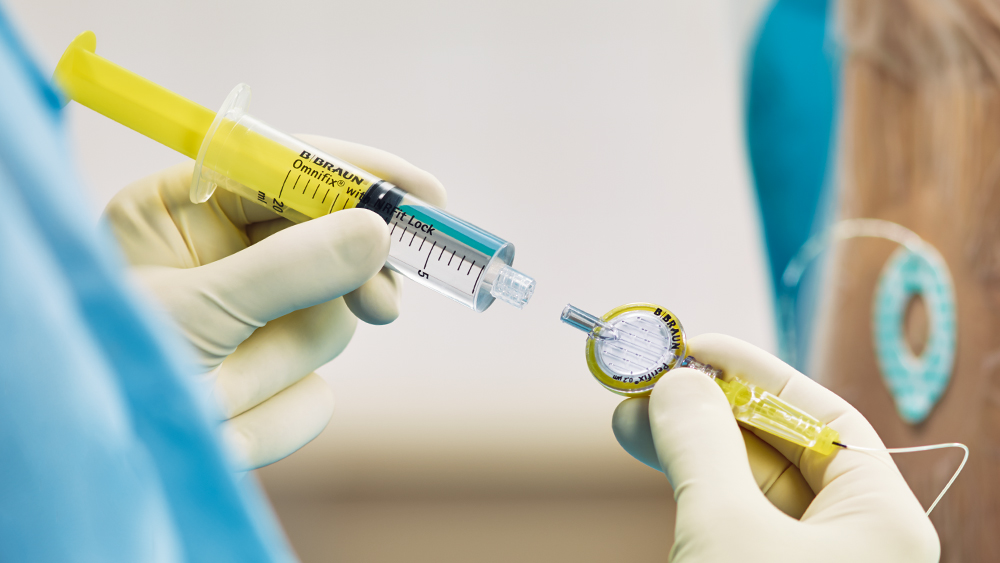 A syringe filled with medication is connected to a filter that has a special connector for region anesthesia.